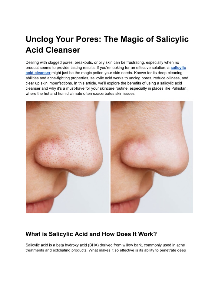 unclog your pores the magic of salicylic acid