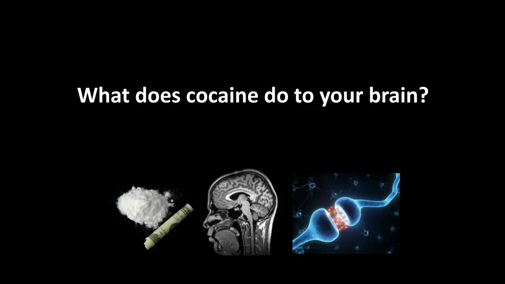 what does cocaine do to your brain