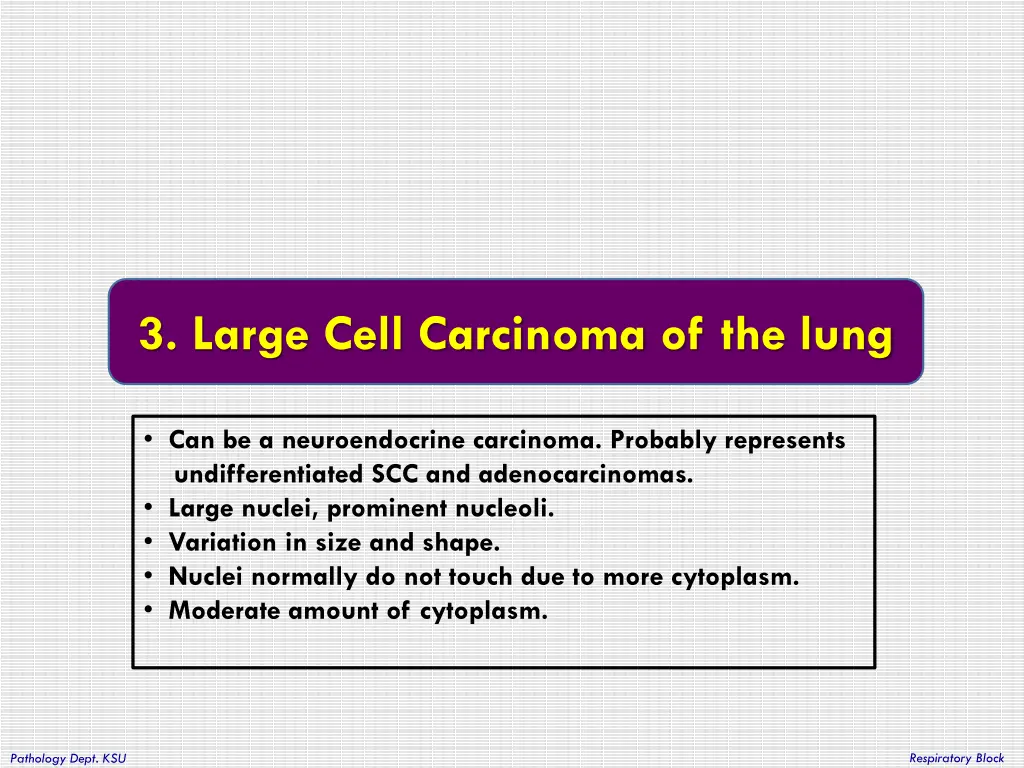 3 large cell carcinoma of the lung