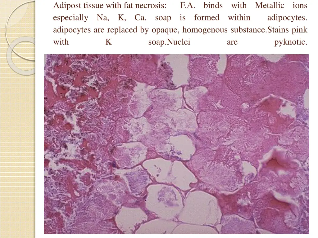 adipost tissue with fat necrosis especially