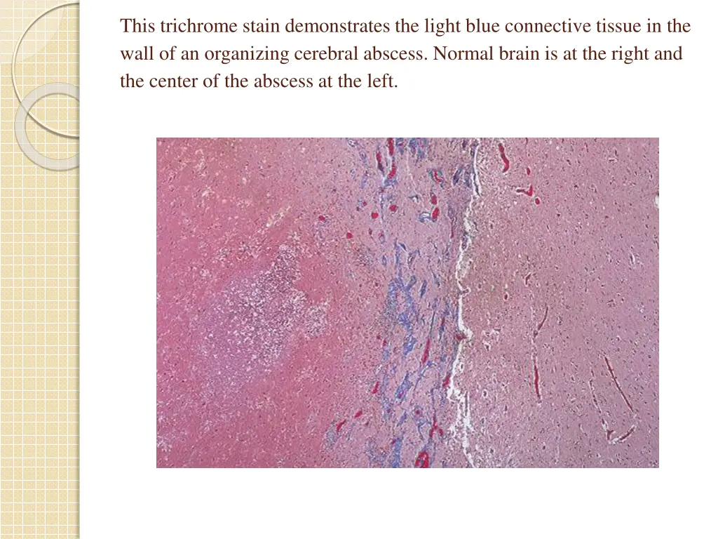 this trichrome stain demonstrates the light blue