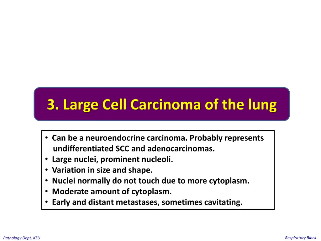 3 large cell carcinoma of the lung