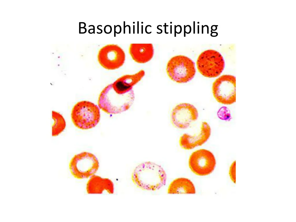 basophilic stippling