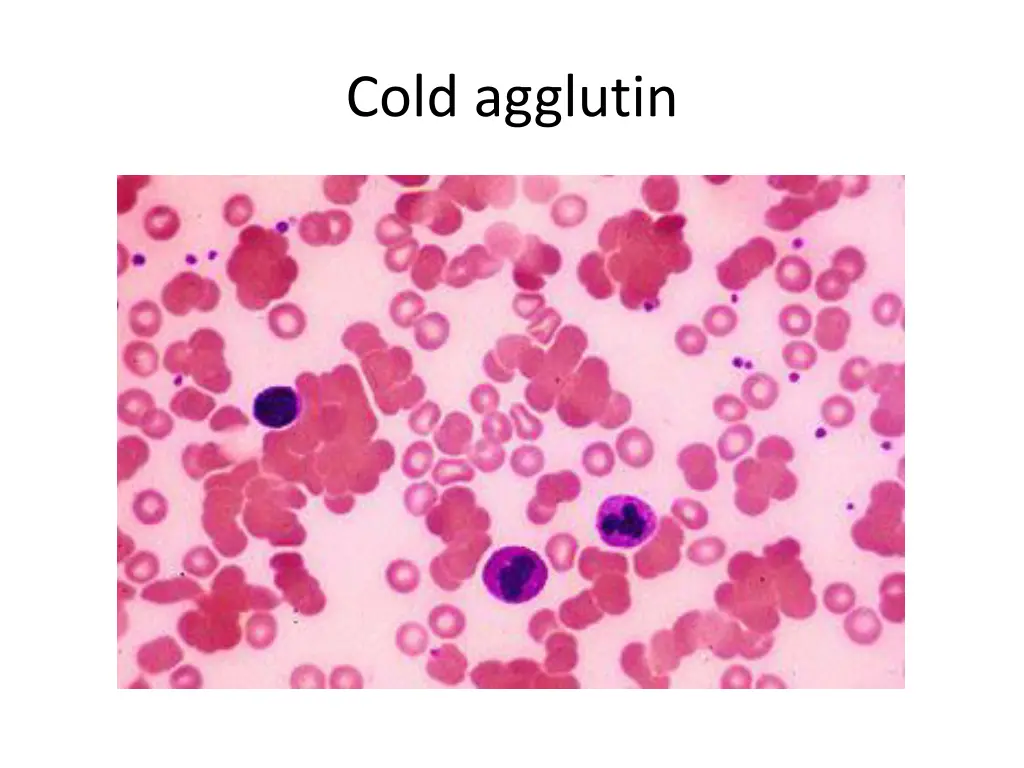 cold agglutin