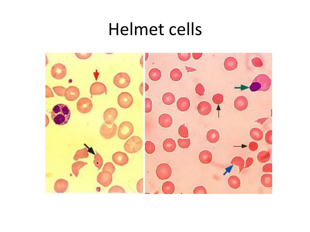 helmet cells