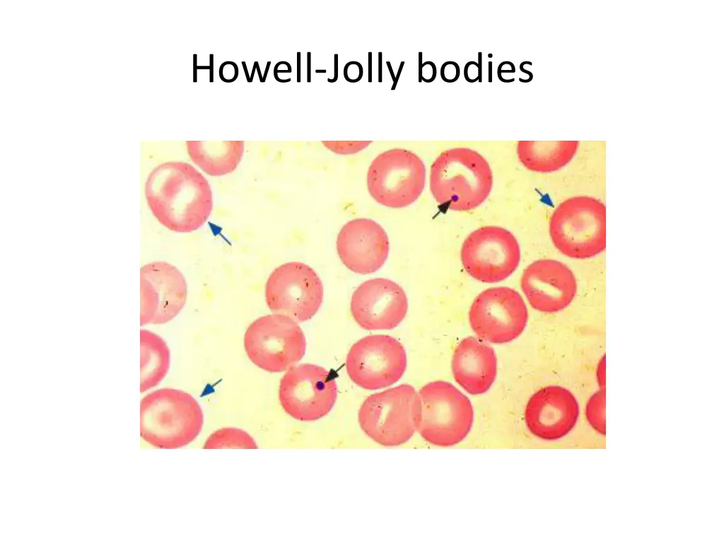 howell jolly bodies