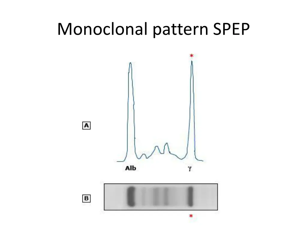 monoclonal pattern spep