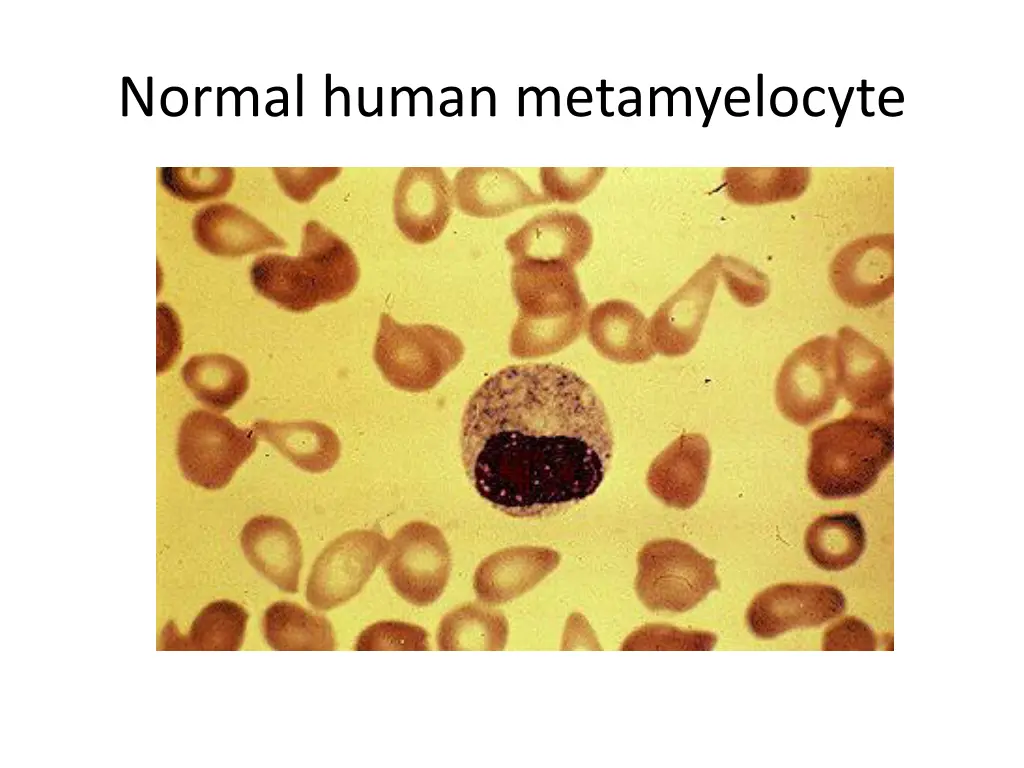 normal human metamyelocyte