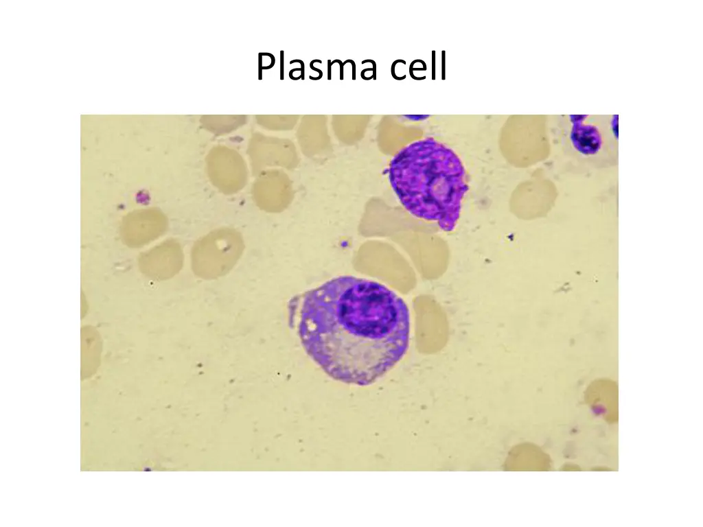 plasma cell