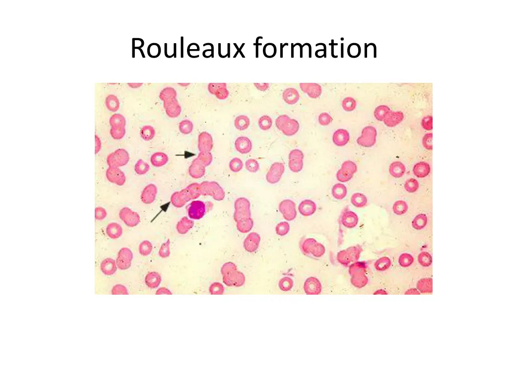 rouleaux formation 1