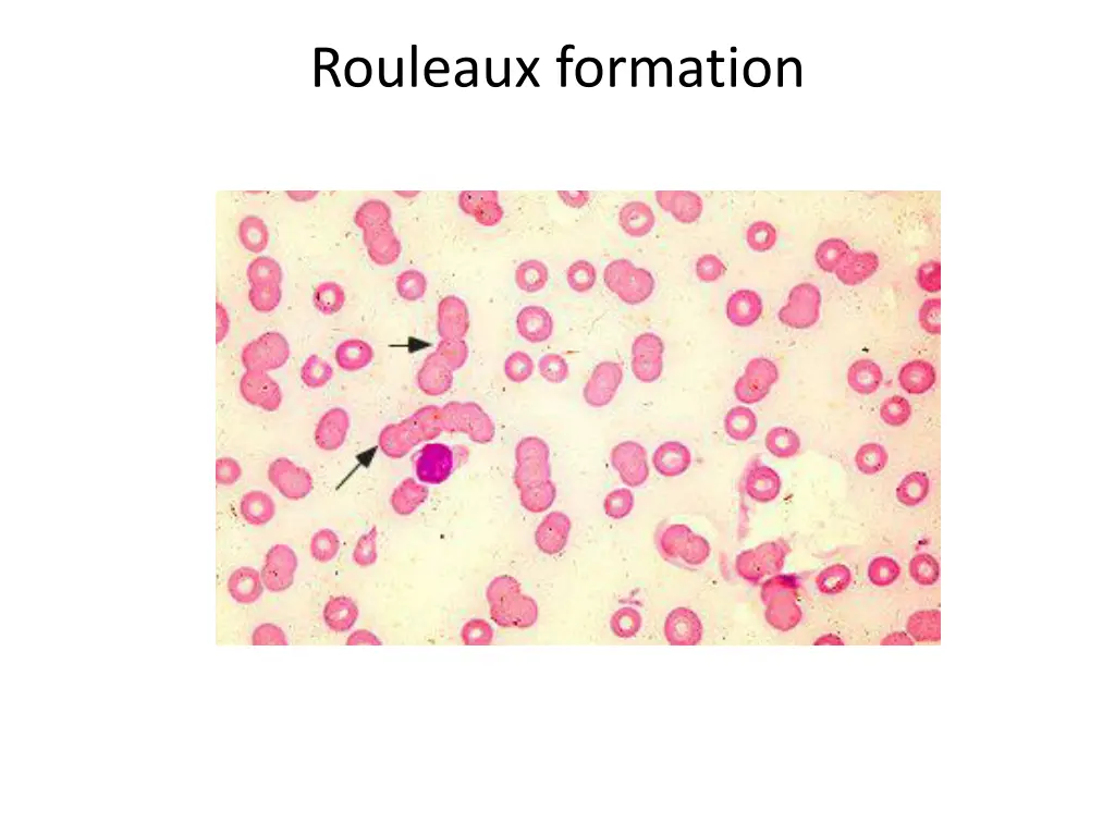 rouleaux formation