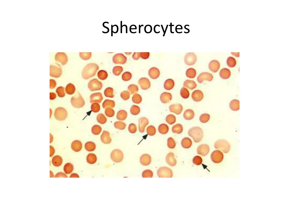 spherocytes