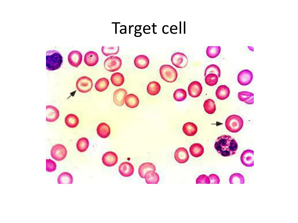 target cell