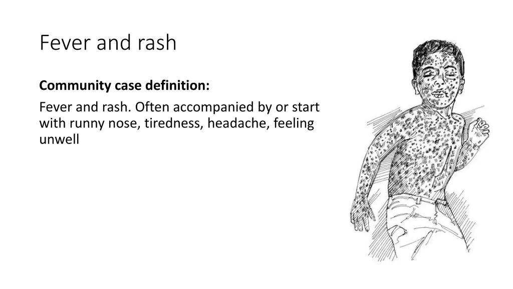 fever and rash