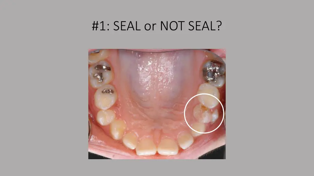 1 seal or not seal