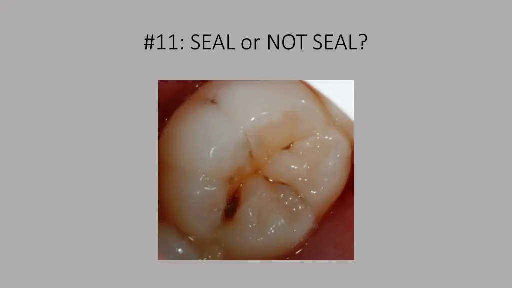 11 seal or not seal