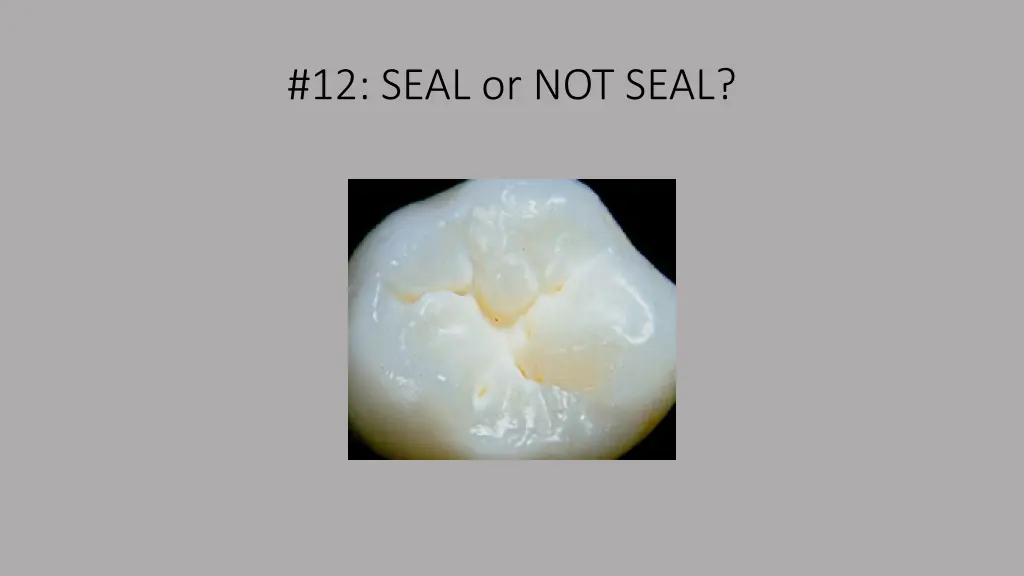 12 seal or not seal