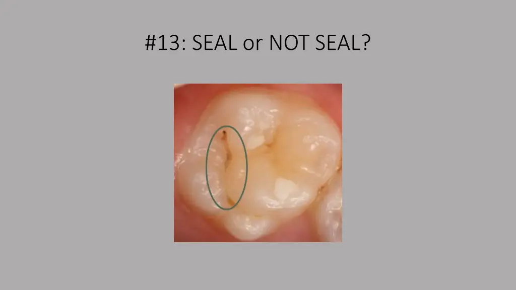 13 seal or not seal