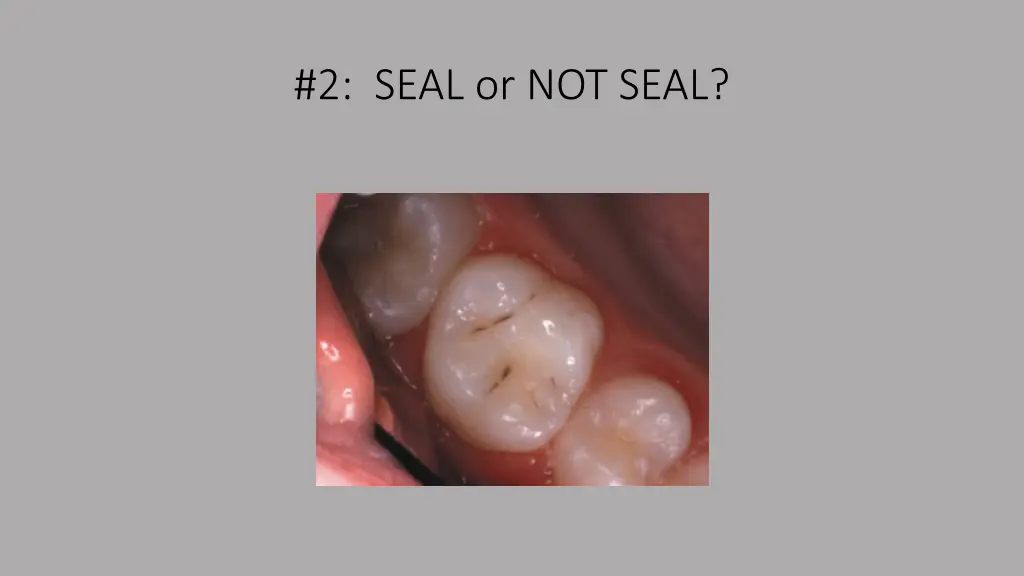 2 seal or not seal