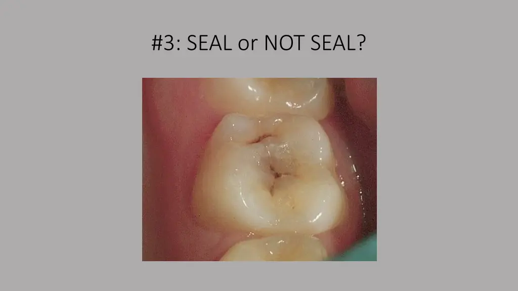 3 seal or not seal