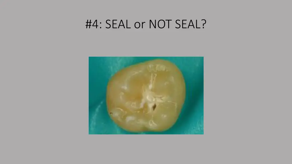 4 seal or not seal