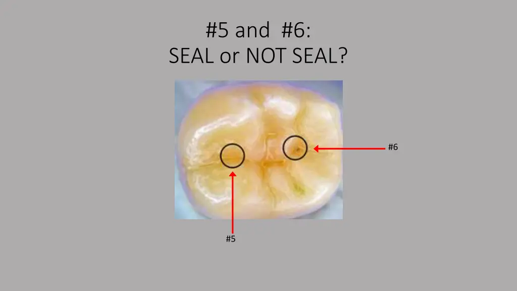 5 and 6 seal or not seal