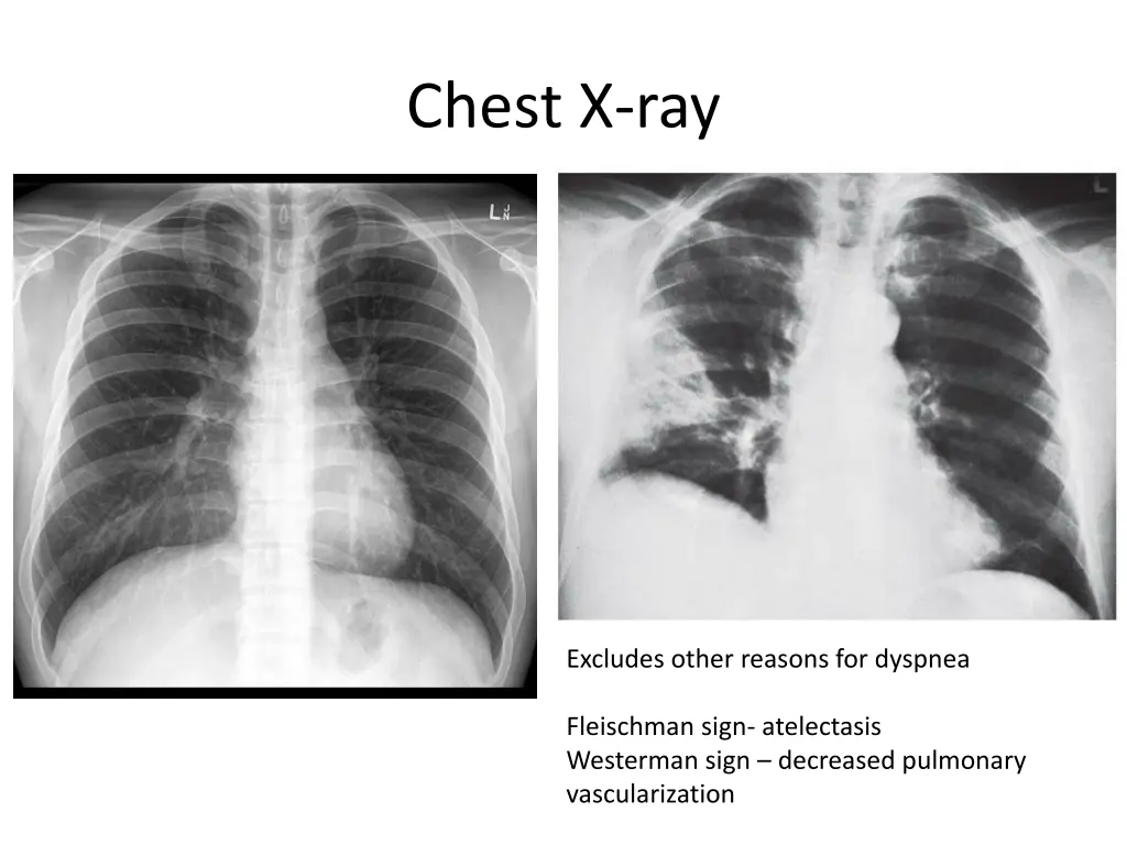 chest x ray