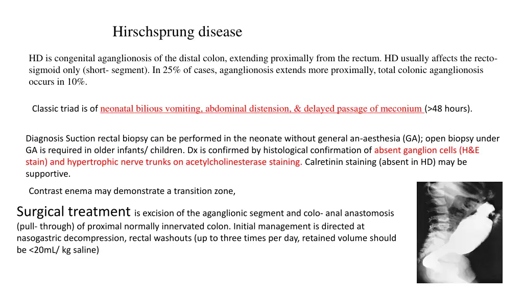 hirschsprung disease