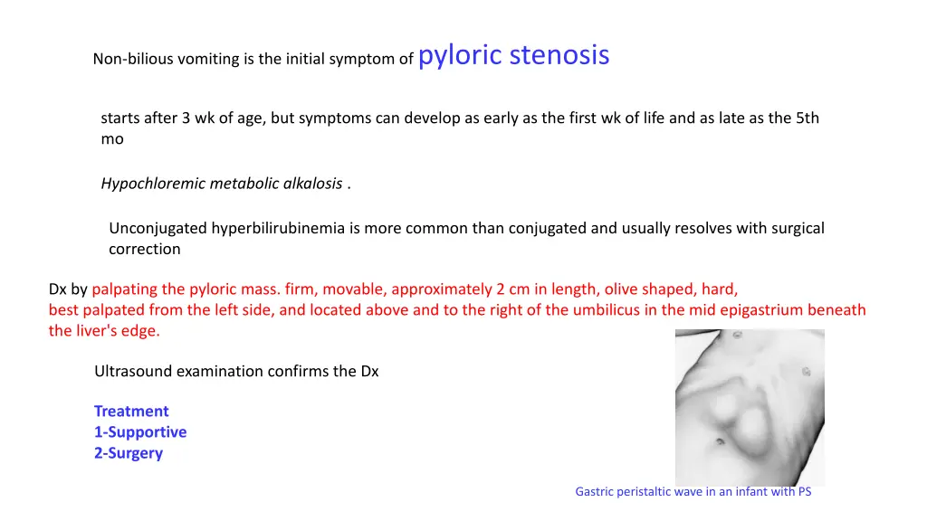 non bilious vomiting is the initial symptom