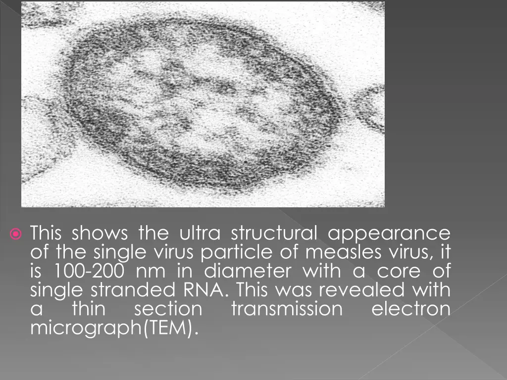 this shows the ultra structural appearance