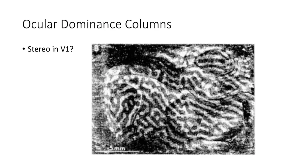 ocular dominance columns