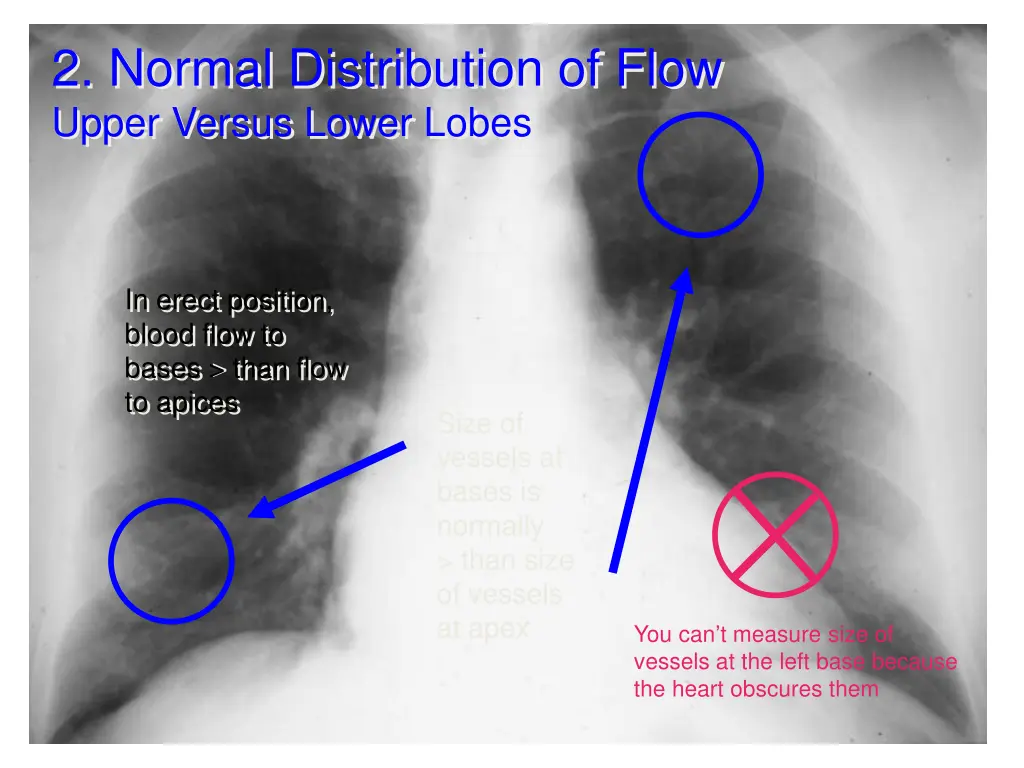 2 normal distribution of flow upper versus lower