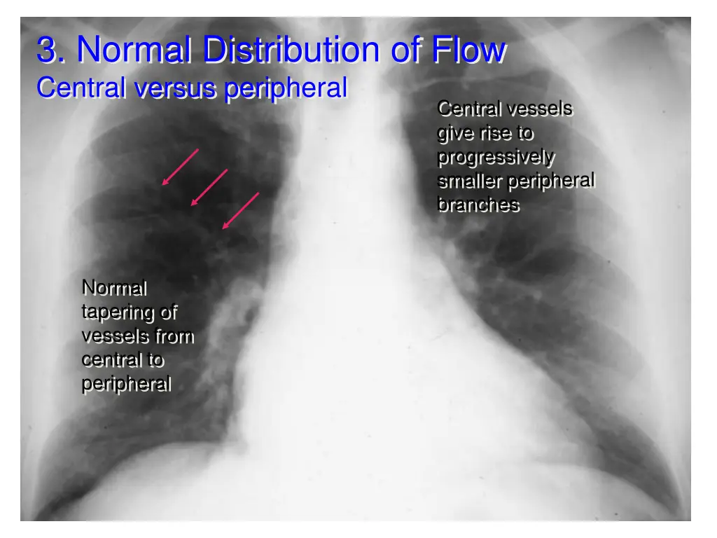 3 normal distribution of flow central versus