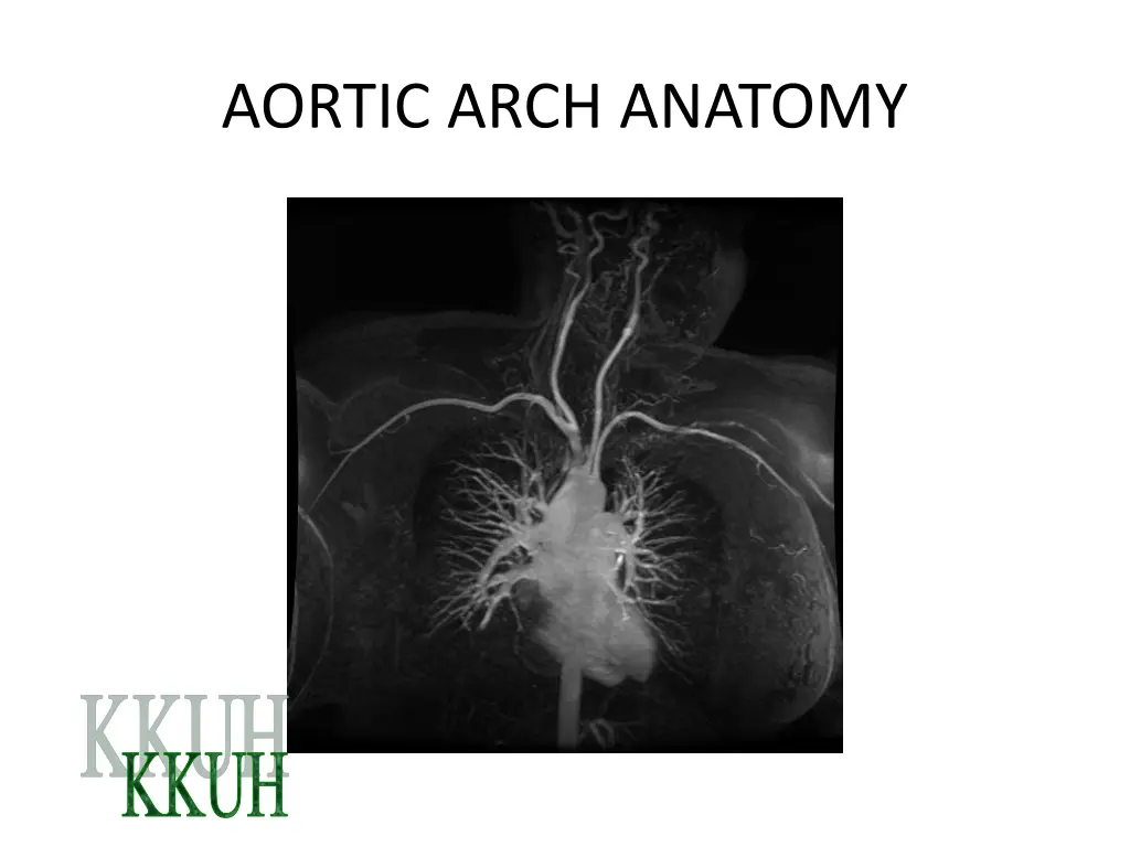 aortic arch anatomy