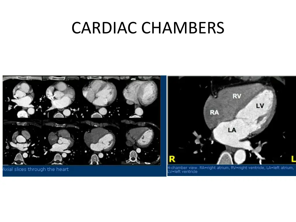 cardiac chambers