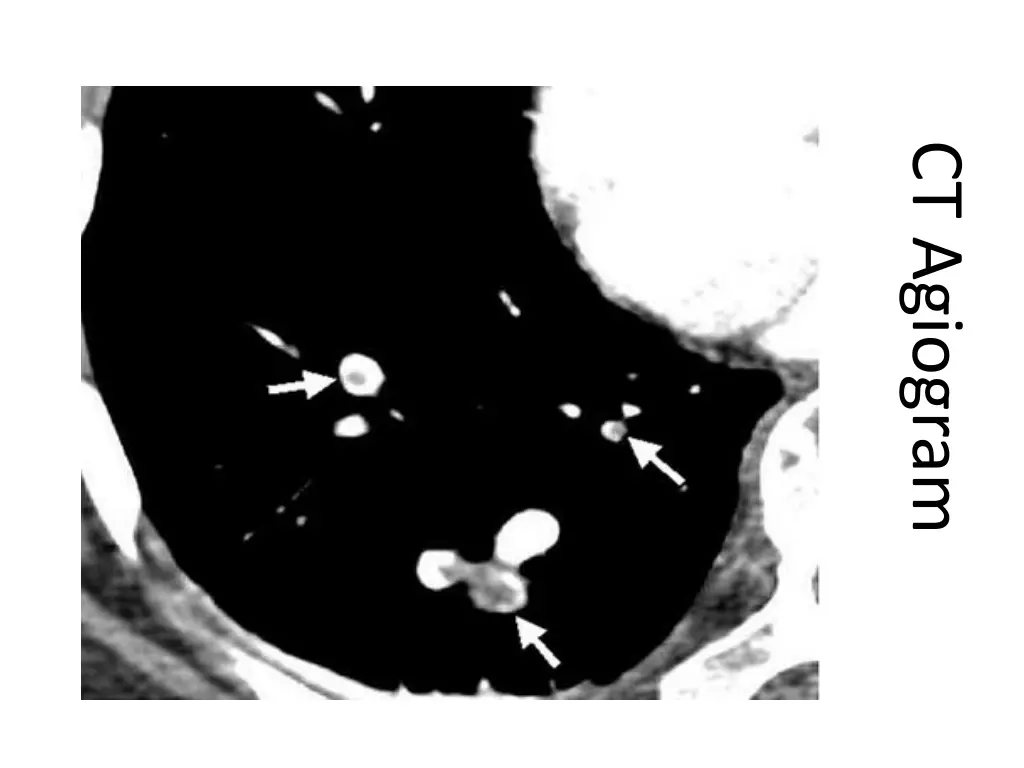 ct agiogram