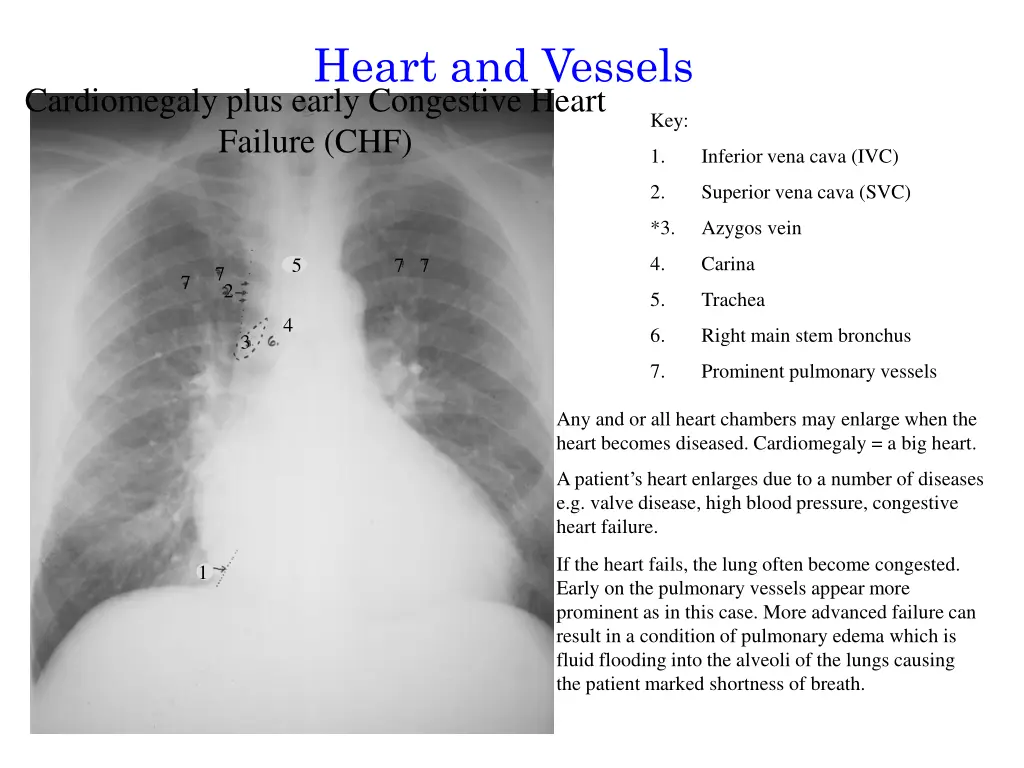 heart and vessels