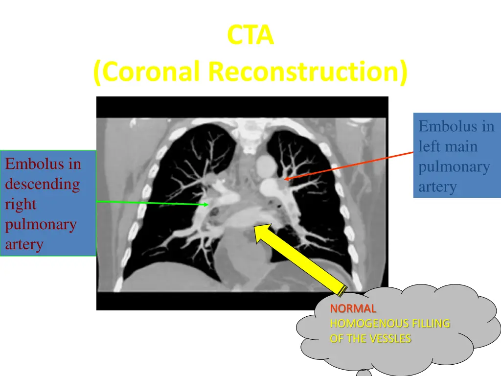 slide13