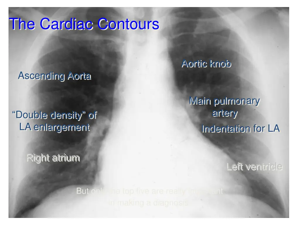 the cardiac contours 1