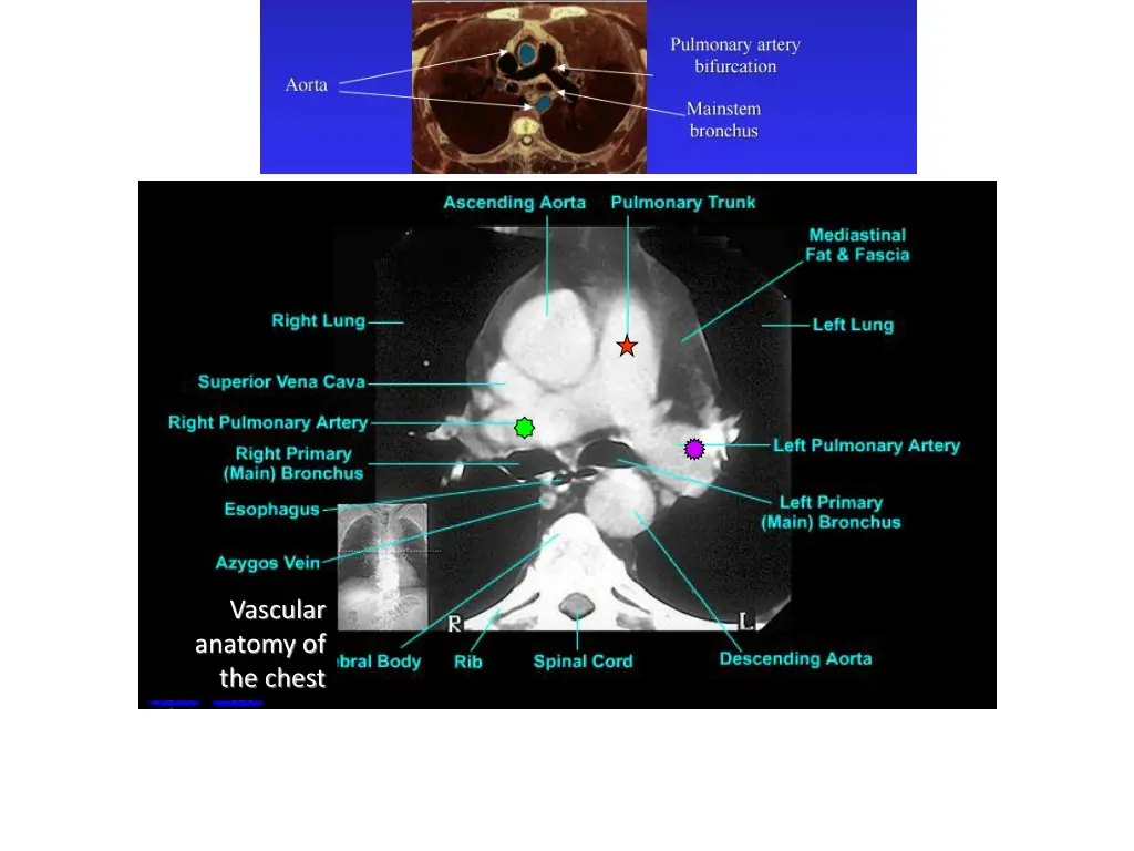 vascular anatomy of the chest 1