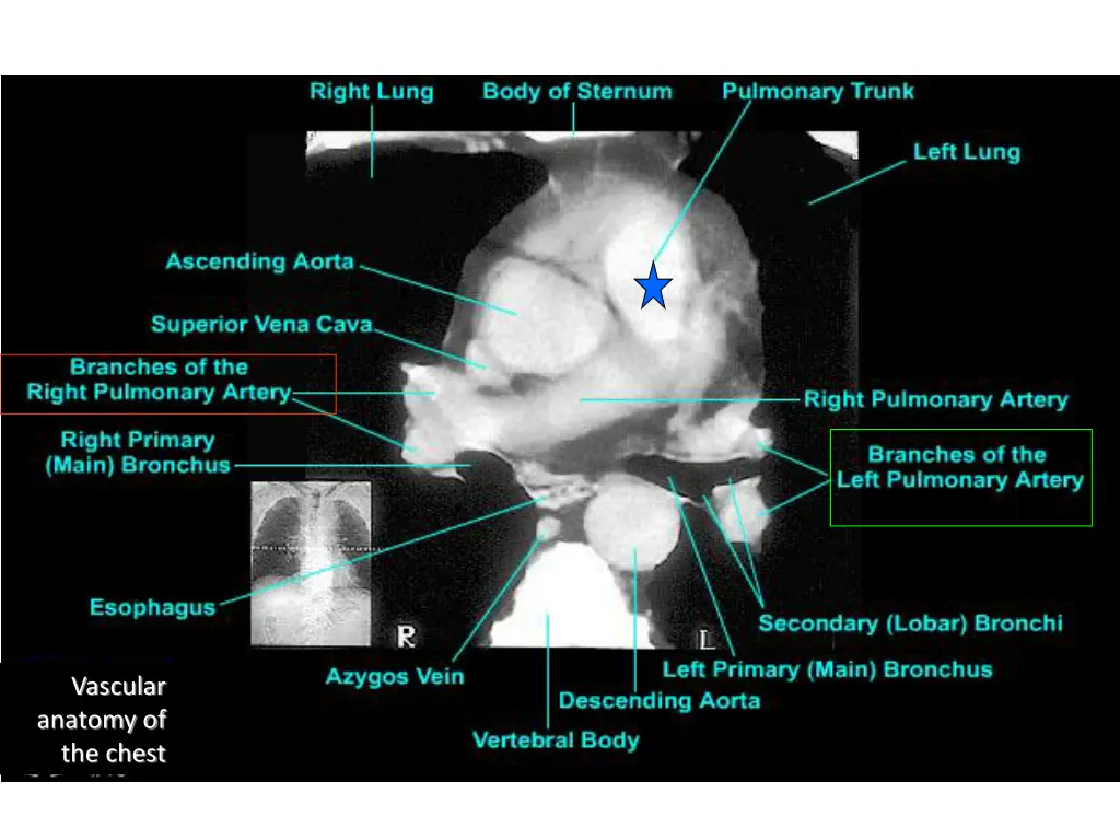 vascular anatomy of the chest 2