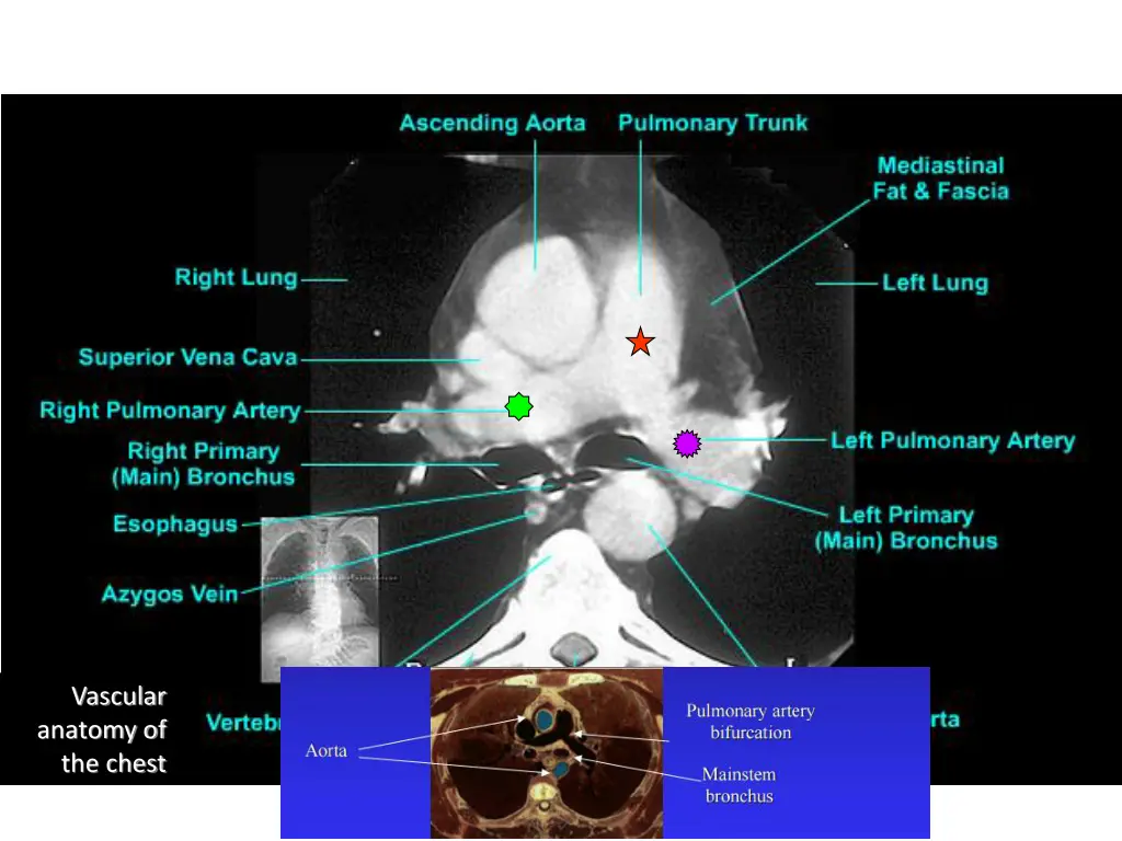 vascular anatomy of the chest