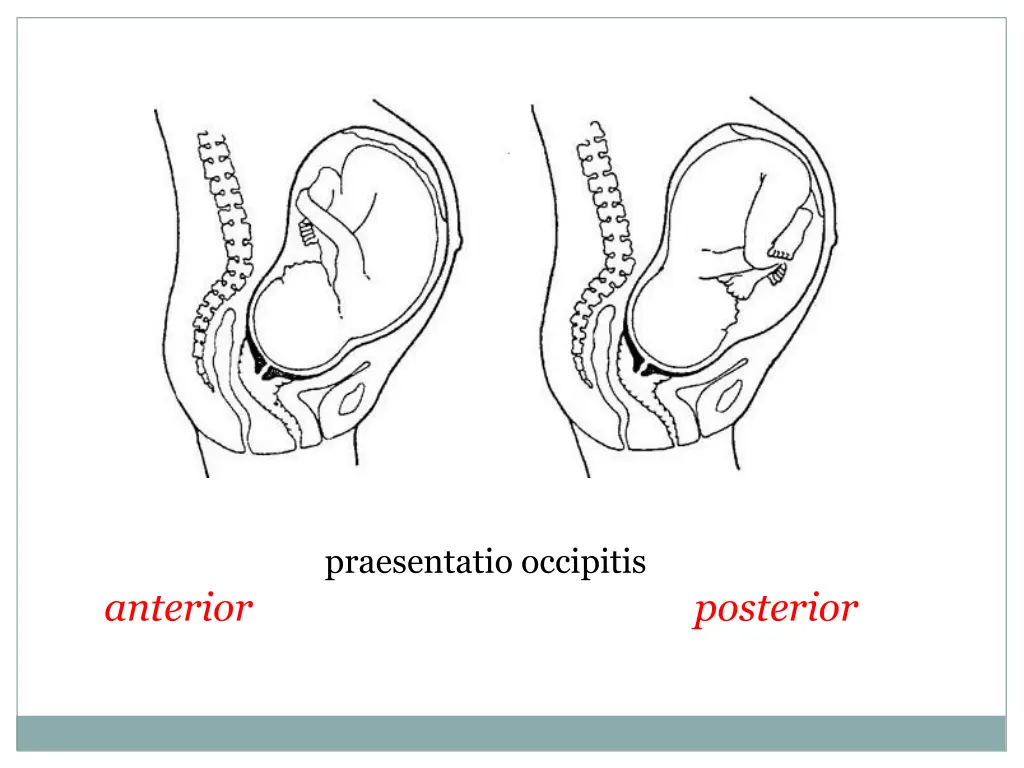 praesentatio occipitis