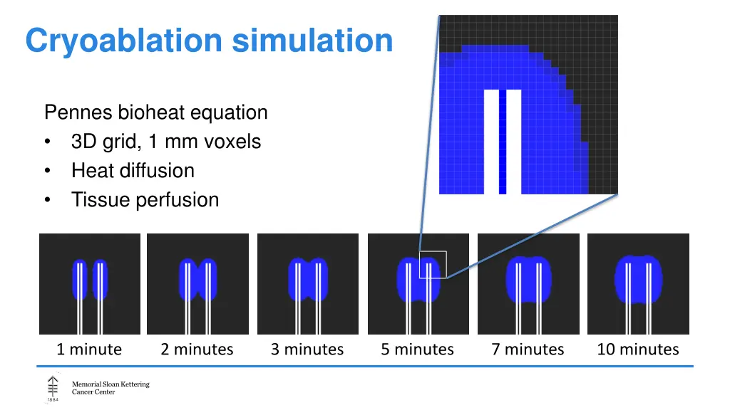 cryoablation simulation