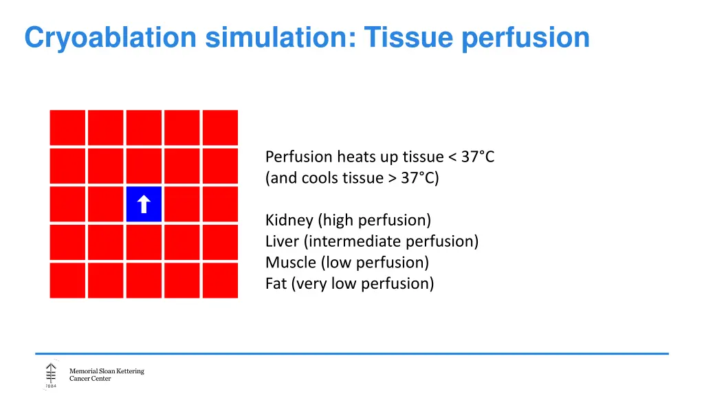 cryoablation simulation tissue perfusion