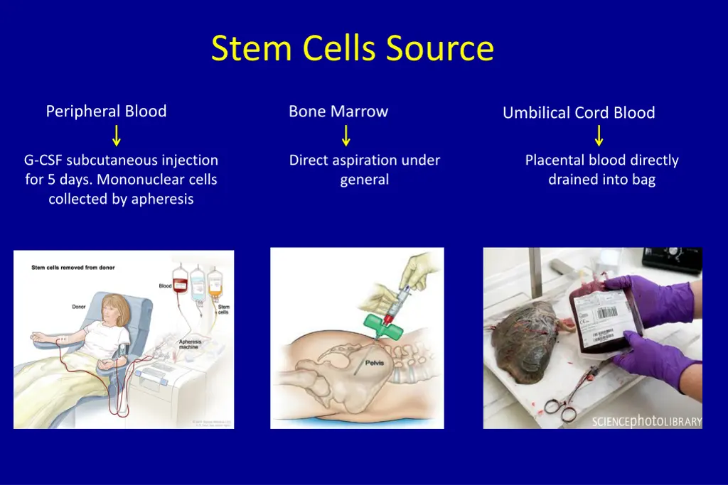 stem cells source