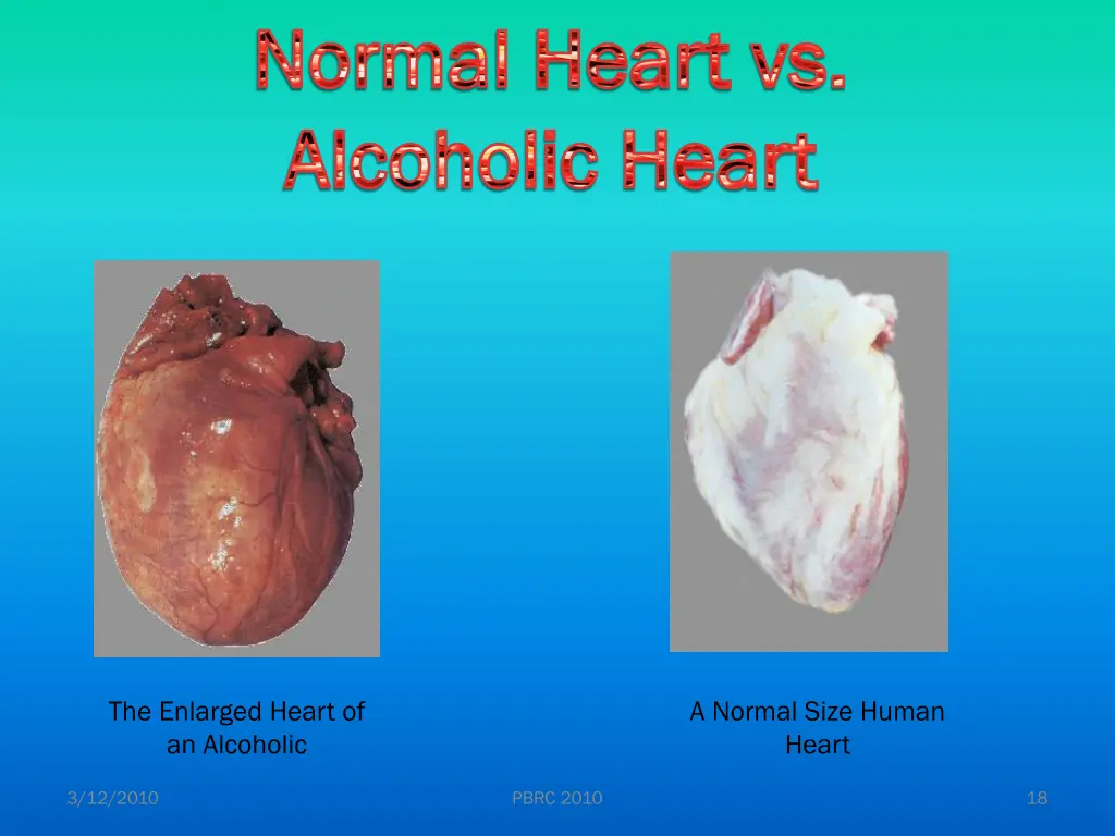 normal heart vs normal heart vs alcoholic heart