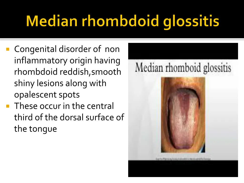 congenital disorder of non inflammatory origin