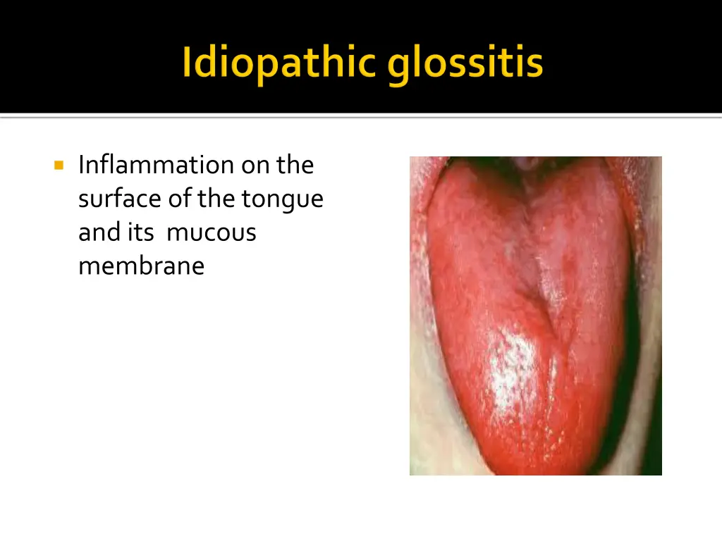 inflammation on the surface of the tongue