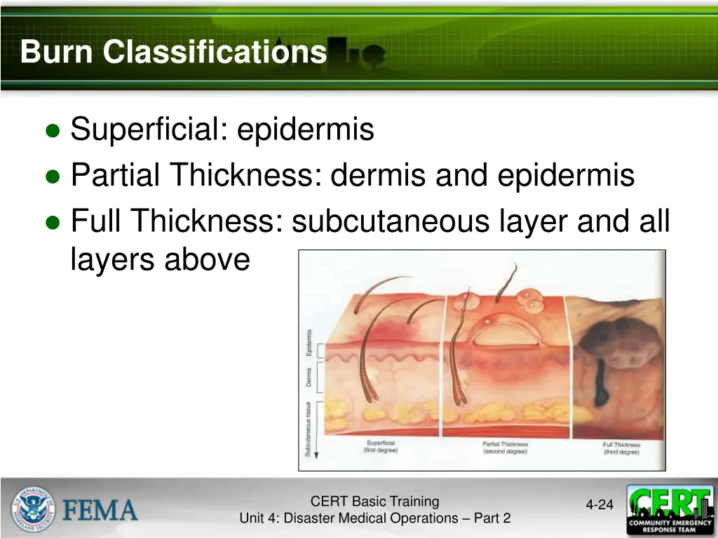 burn classifications